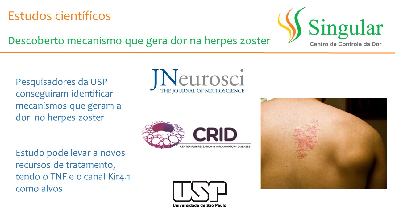 causa da dor no herpes zoster2